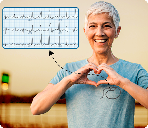 cardiac-implant-monitoring-2