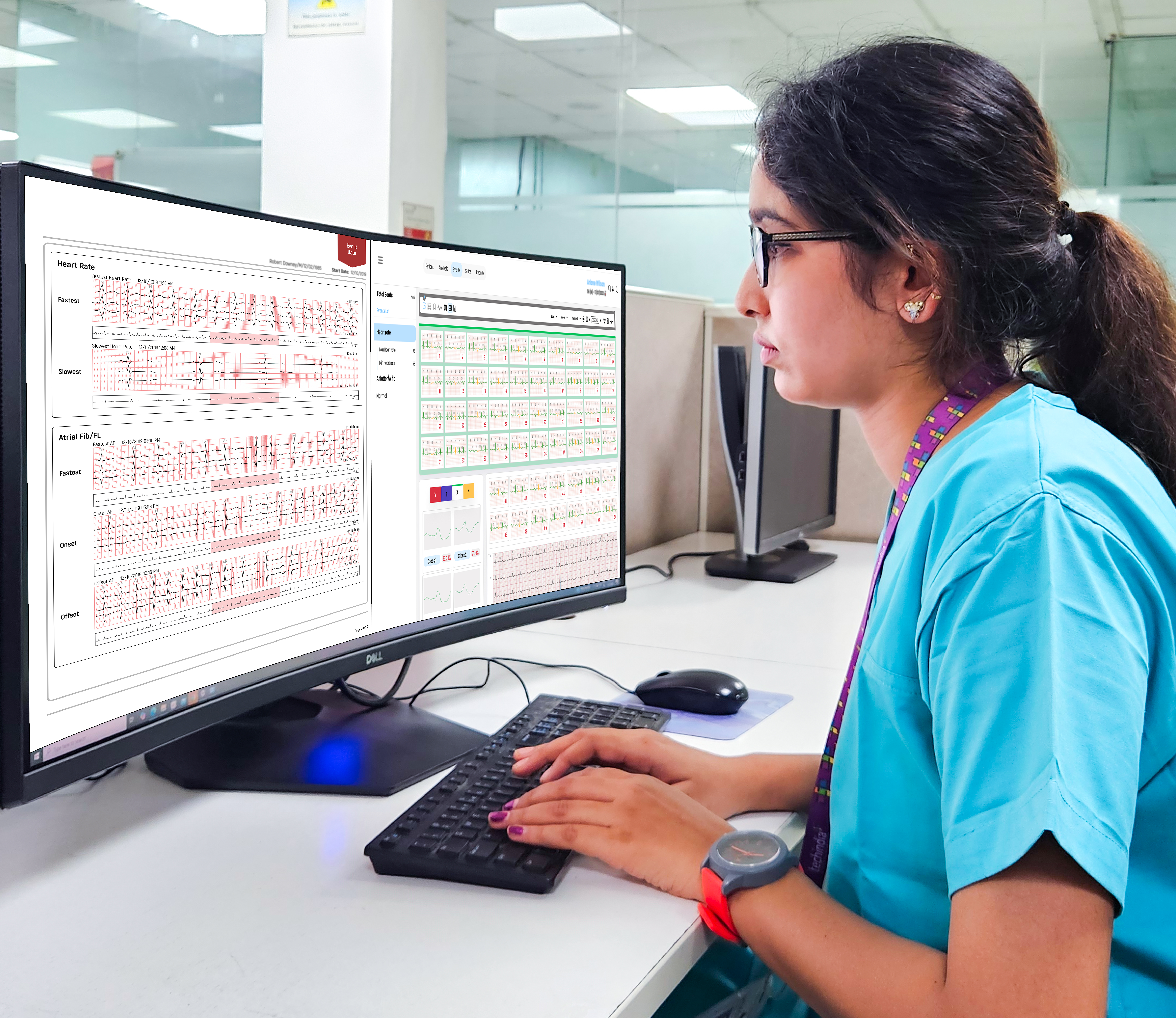 cardiac-interpretation-services-2