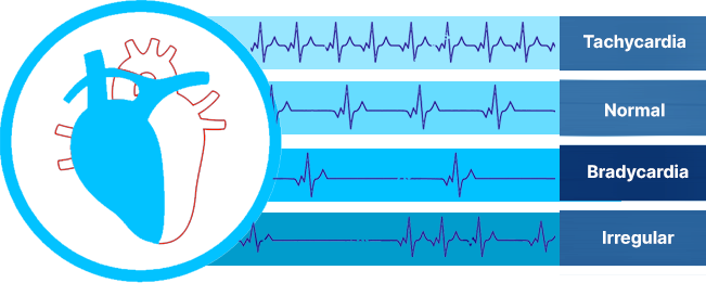 cardiac-rhythm-interpretation-concept-image